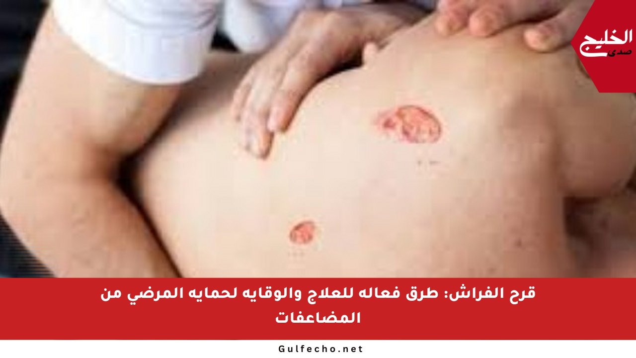 قرح الفراش: طرق فعالة للعلاج والوقاية لحماية المرضى من المضاعفات